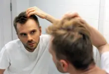 میدونی علت ریزش موی مردان چی هست؟